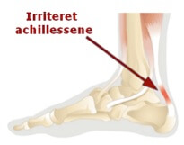Ømhed i achillessenen - Genoptræn en akillessene - Se videoen her!