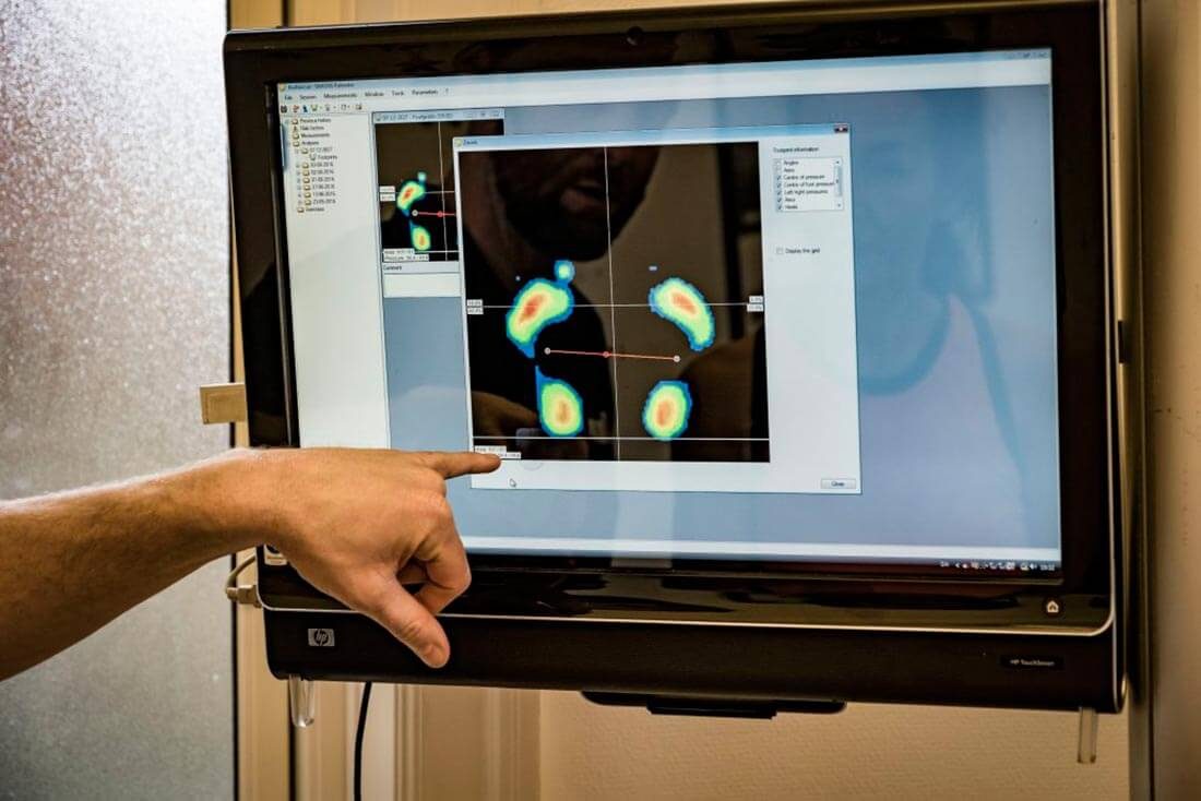 Hånd peger på fodtryksmåling vist på en skærm i klinikken