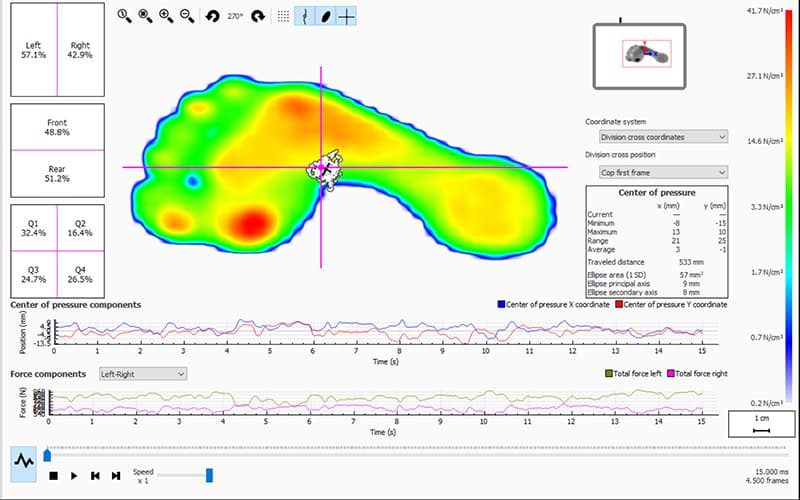 Klinik Sport Lab Loebestilsanalyse