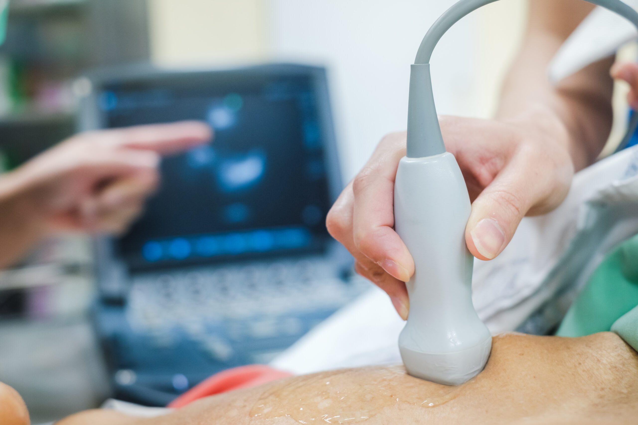 Hånd holder ultralydssonde mod patientens mave med gel under scanningen